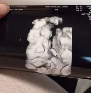 Meet your Posher, Sommer